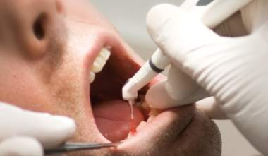 Milhares podem ter sido infectadas com HIV em clínica dentária